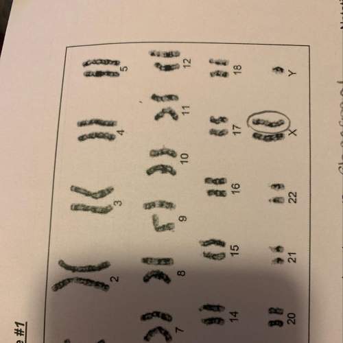 Go back to karyotype #1. describe the chromosomal abnormality in the gametes that created the zygote