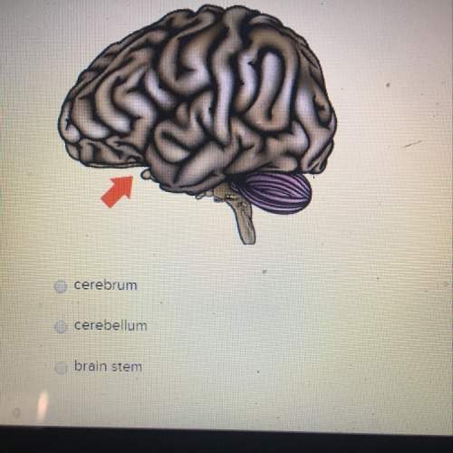 What part of the brain is the arrow pointing to?