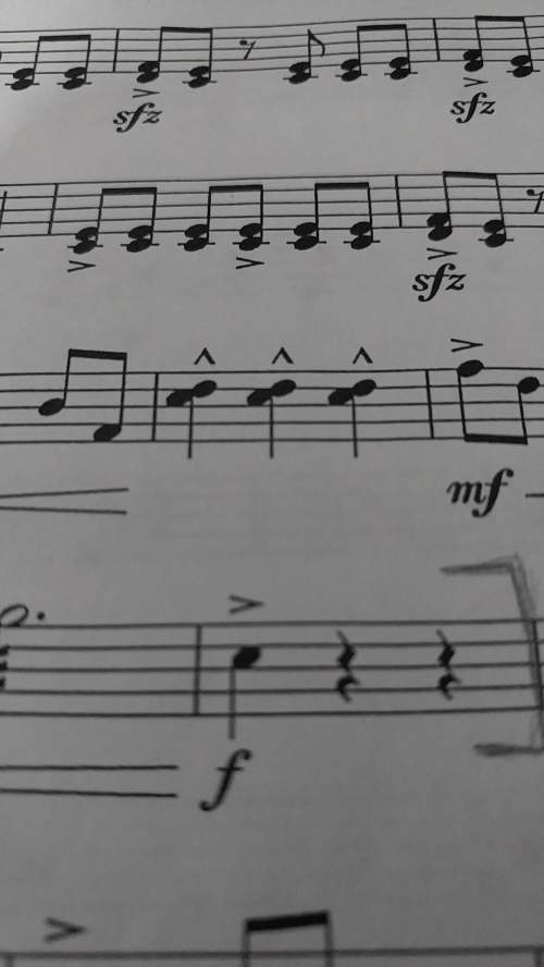 What is this type of note, the accented quarter notes with the black circles on both sides? (the in