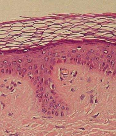 What type of tissue is this nervous tissue, muscle tissue, connective tissue, or epithelial