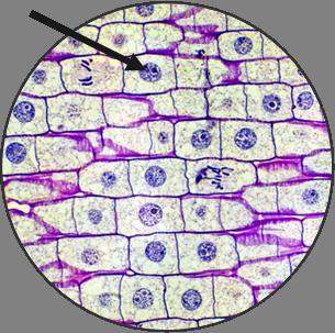 Which structure is the arrow pointing to? what is the function of this organell