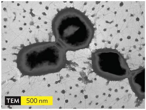 Consider the following image of porphyromonas gingivalis viewed using transmission electron microsco