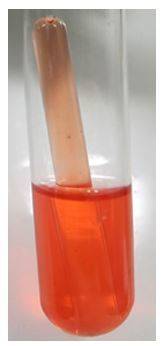 What can you conclude based on your observation of the pictured glucose (dextrose) fermentation test