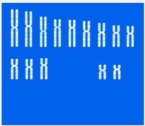 Using the karyotype above, answer the following questions:  1. which of these set