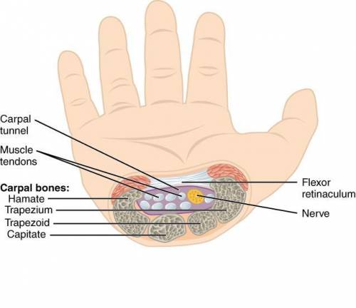 Which anatomical term describes the wrist region?   a) carpal  b) tarsal  c) digital  d) perineal  e