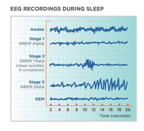 If the eeg record reveals evidence of very small and very fast waves in a person that otherwise appe
