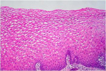 The image below shows a type of human tissue. what is its function? a)binding organs and tissues to