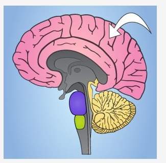 Which part of the brain is indicated by the arrow below? a. cerebrum b. cerebellum c. pons d. medul