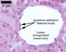 Simple squamous epithelium is a stacked, double layer of cells is a single layer of flattened cells