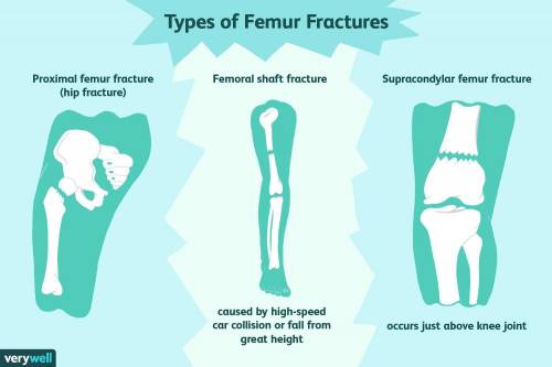 How does the shape of the treated femur compared with that of the untreated femur?