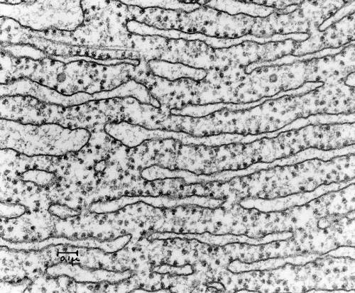 What causes rough endoplasmic reticulum to look “rough” under a microscope?   a rough er has lots of
