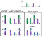 Trisomy-21 results from a mutation to the chromosomes in a.body cells  b.somatic cells  c.gametes  d