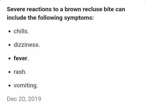 ⚠️

Someone please if possible help show me/list Possible symptoms of what a brown recluse can do to