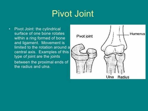 2) Which type movement do pivot joints allow?