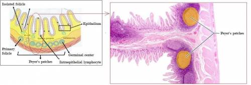 Which structures are highlighted? Which structures are highlighted? duodenal glands Peyer's patches