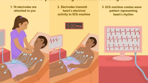 BRAINLIEST TO WHO GETS THIS RIGHT

Which of the following are true about ECG machines? Check all of