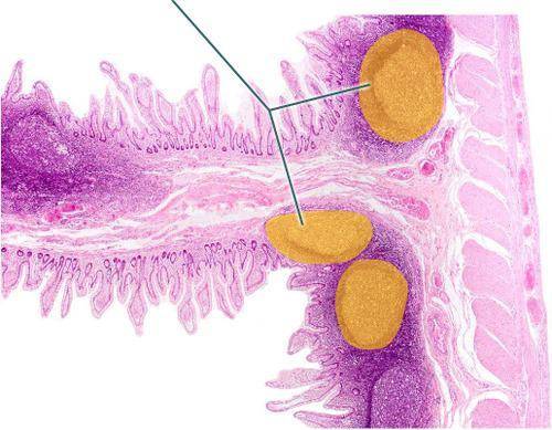 Which structures are highlighted? Which structures are highlighted? Peyer's patches germinal centers