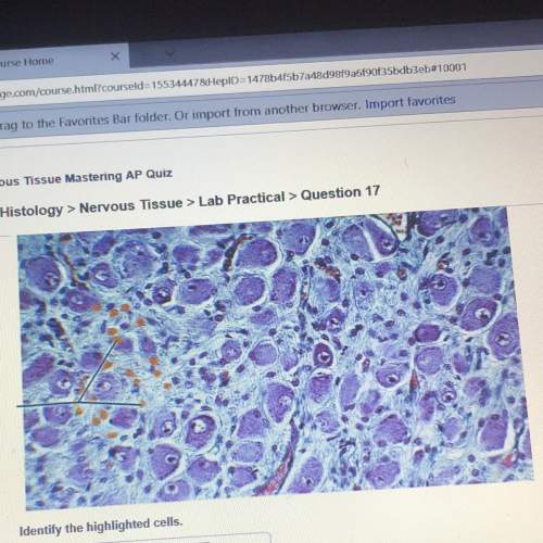 Identify the highlighted cells of nervous tissue