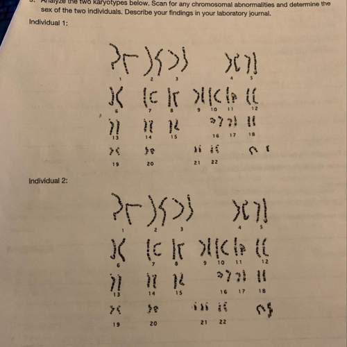 Analyze the two karyotype. scan for any chromosomal abnormalities and determine the sex of the indiv