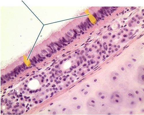 Which structures are highlighted? Which structures are highlighted? goblet cells submucosa chondrocy