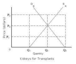 Refer to exhibit 4-5. if a free market were allowed in the transplanted kidney market, then the equi