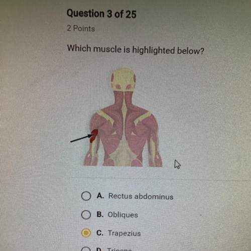 Which muscle is highlighted below?