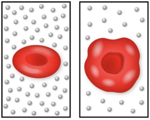 Asap giving brainliest the image on the left shows a normal red blood cell, and the image on the rig