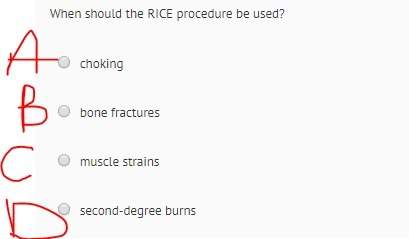 When should the rice procedure be used?