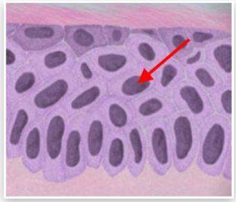 What is the structure labeled with an arrow? a) cytoplasm&lt;