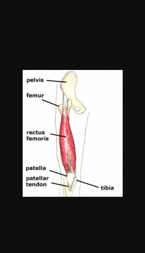 Quads are located

A. Below the femurB. A top the femurC. To the right of the femurD. To the left of