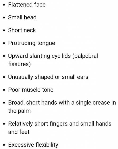 Describe the cause and symptoms of Down syndrome.