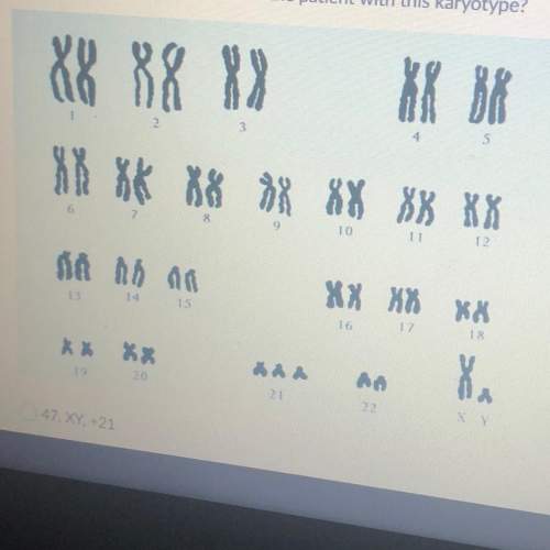 which notation correctly describes the patient with this karyotype?