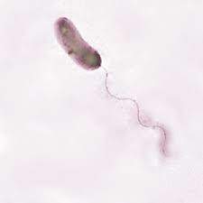 Vibrio cholerae produces a toxin that binds to a plasma membrane receptor on intestinal cells of the