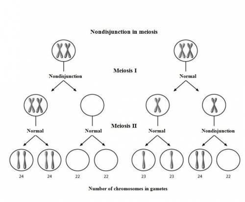 The table above shows five different types of chromosomal abnormalities that can occur during meiosi