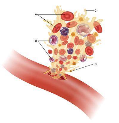 Which of the blood components in the diagram would proliferate during a viral infection? A B C D