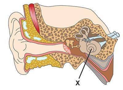 This is a diagram of the ear. Which is the function of structure X?  It sends information to the ner