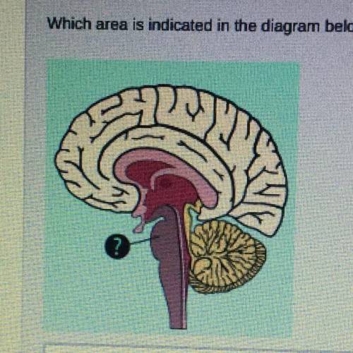 Which area is indicated in the diagram below? Please help