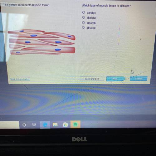 What type of muscle tissue is pictured?