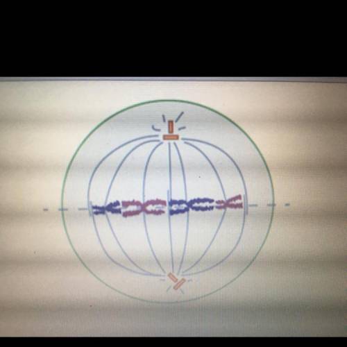 This cell is in which stage of mitosis?