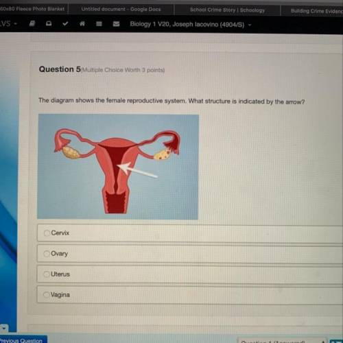 The diagram shows the female reproductive system. What structure is indicated by the arrow? Cervix O