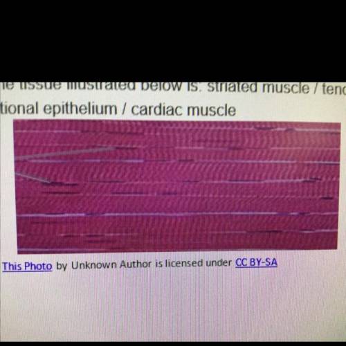 The tissue the picture above is:  A. Striated muscle B. Tendon C. Smooth muscle D. Transitional epit