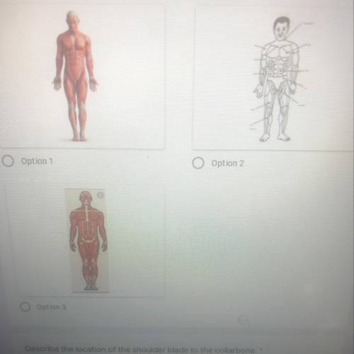Which best shows Anatomical position?