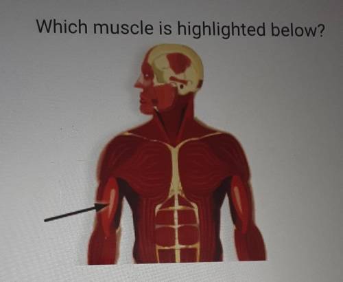 Which muscle is highlighted below?

O A. ObliquesO B. Latissimus dorsiO C. Biceps brachiiO D. Rect