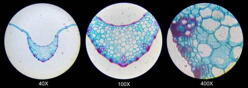 Based on the images taken through Stella’s microscope, which cell structures could be clearly ident