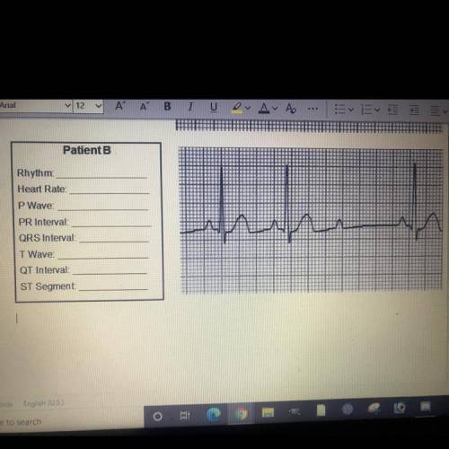 Anatomy and physiology 
Find the rhythm and etc of patient b heart rate