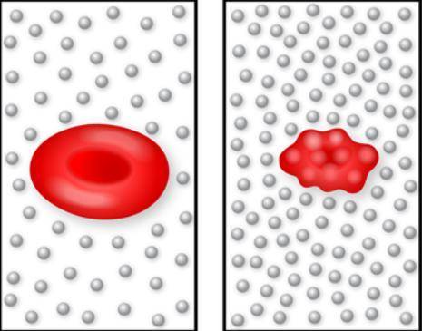 In which direction did the water move to make the red blood cell shrink? Why did water move in that