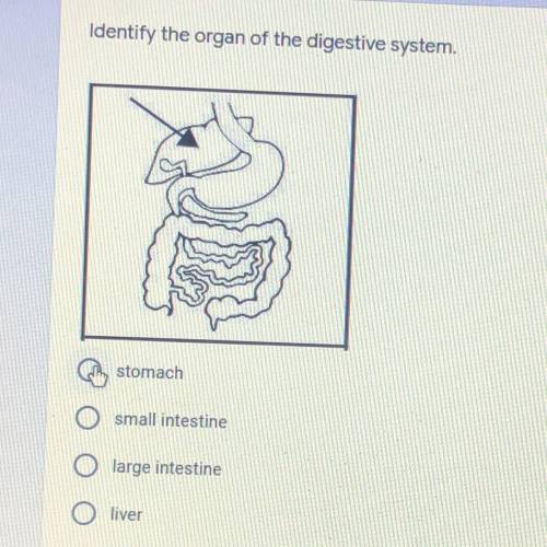 Identify the organ of the digestive system. A)stomach

B)small intestine
C)large intestine
D)liver