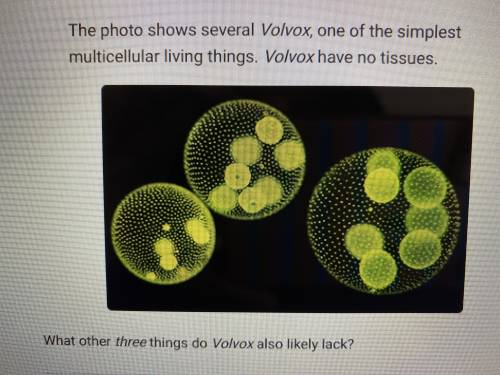 The photo shows several Volvox, one of the simplest multicellular living things. Volvox have no tis