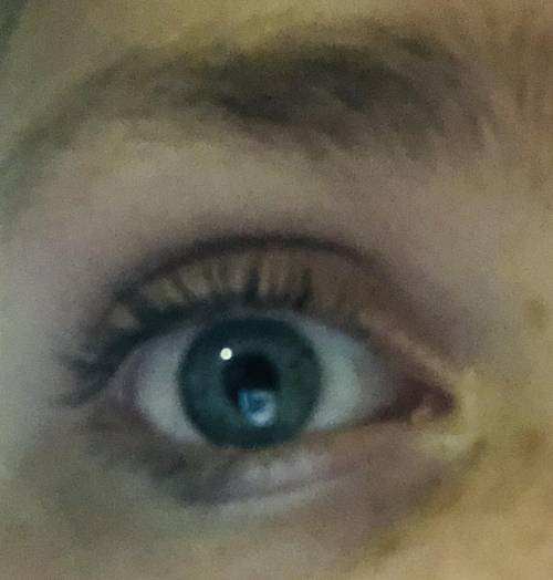 What color is my eye ???