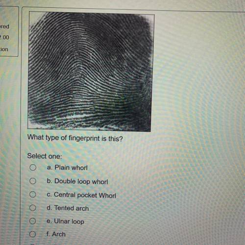 What type of fingerprint is this?

Select one:
a. Plain whorl
b. Double loop whorl
c. Central pock
